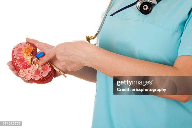 nurse holding a diseased kidney - kidney stone stock pictures, royalty-free photos & images