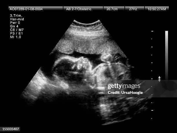 pregnancy ultrasound in 3rd trimester - ultrasound scan stock pictures, royalty-free photos & images