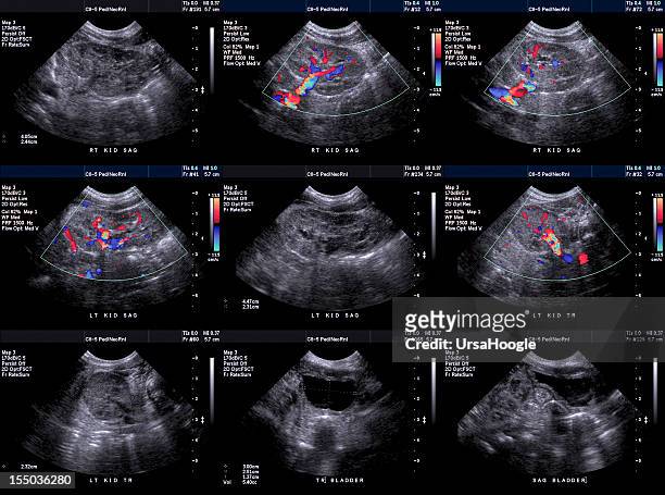 ultraschall-untersuchung von neugeborenen in nieren und blase - baby monitor stock-fotos und bilder
