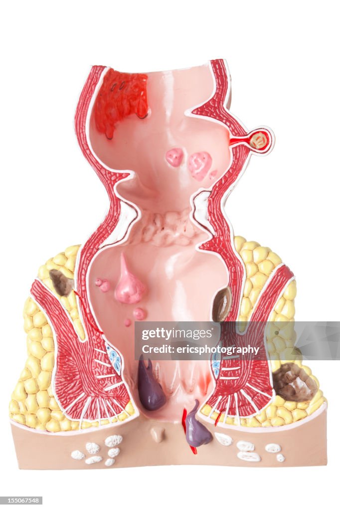 Rectum