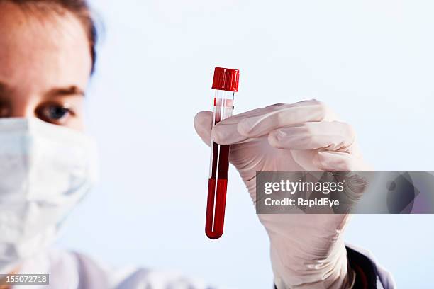 serious young female scientist studies specimen of blood - medicinflaska bildbanksfoton och bilder