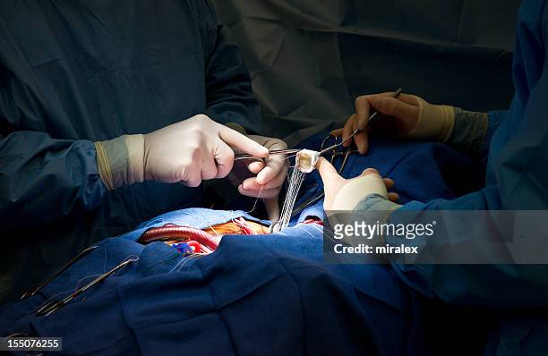heart surgery aortic valve replacement with xenograft - heart surgery stock pictures, royalty-free photos & images