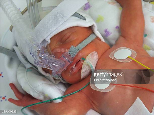 premature in icu - medical oxygen equipment 個照片及圖片檔