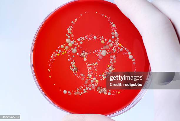 biologische gefährdung - streptococcus stock-fotos und bilder