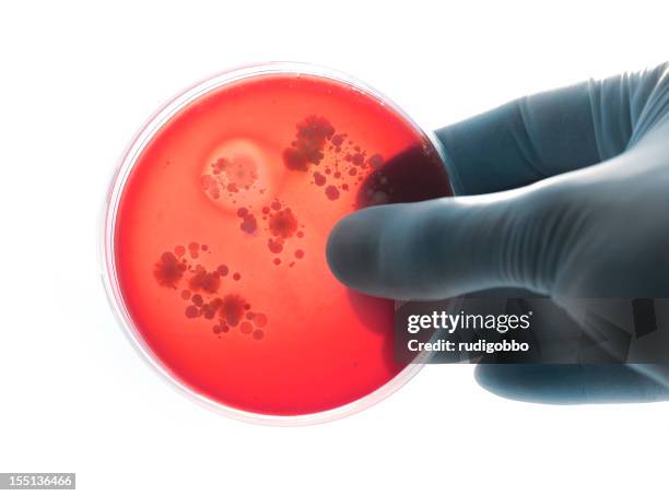 holding bacteria plate - meningitis stock pictures, royalty-free photos & images