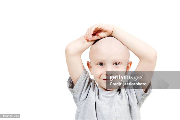 photograph of a happy child undergoing chemotherapy - bald child stock pictures, royalty-free photos & images