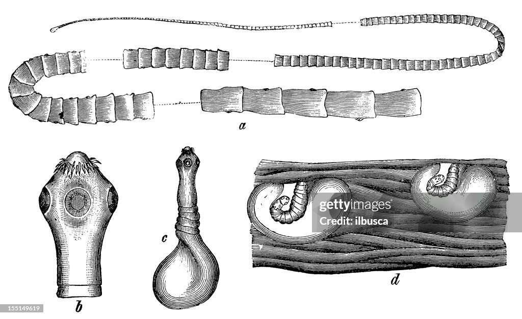 Pork Tapeworm (Taenia Solium)