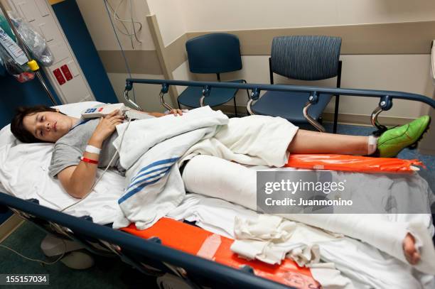 broken leg - broken leg stock pictures, royalty-free photos & images