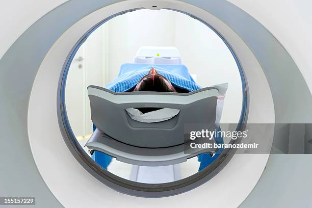 man receiving a medical scan, rear view - radiotherapy stock pictures, royalty-free photos & images