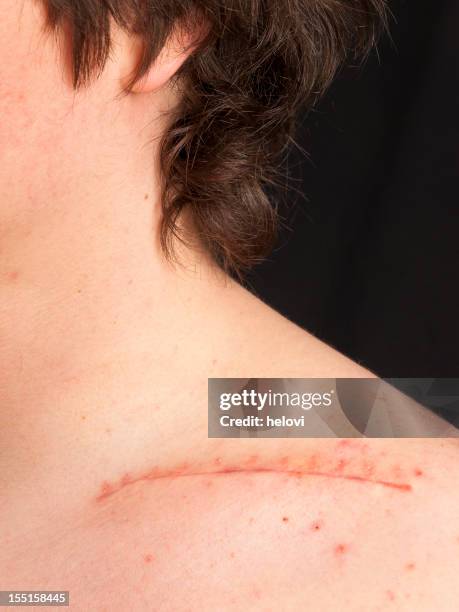 los puntos de collarín - clavícula fotografías e imágenes de stock