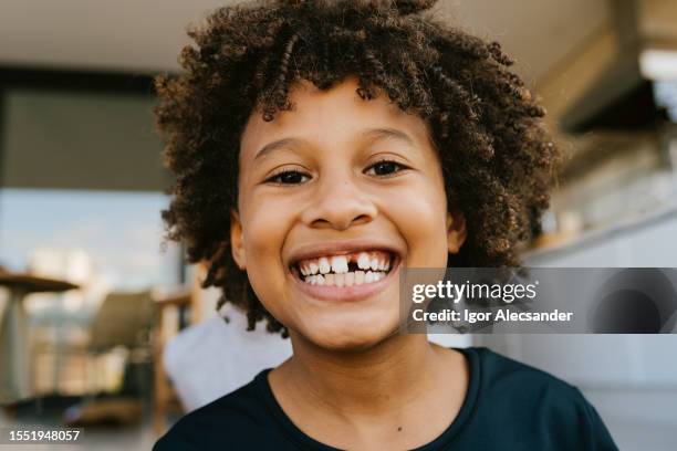 portrait of a toothless boy smiling - children missing teeth stock pictures, royalty-free photos & images