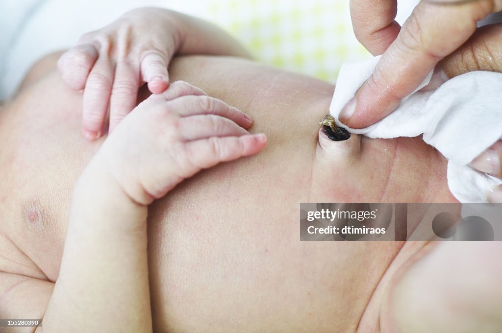 Cleaning a newborn baby's umbilical cord belly button.