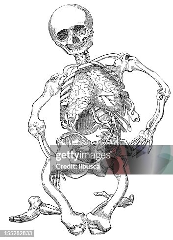 Rickets skeleton Rickets skeleton
