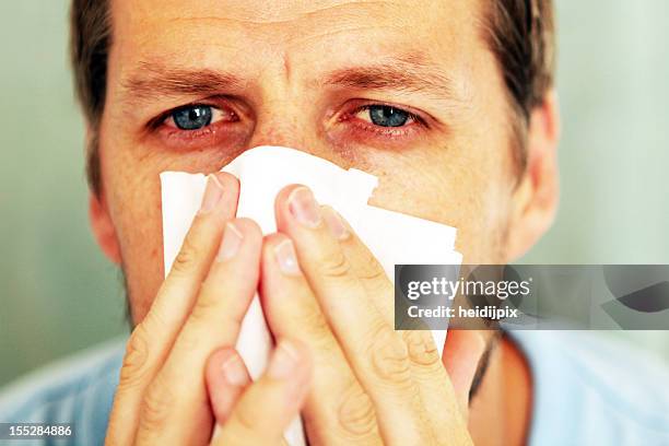 closeup portrait of red eyed man holding tissue to his nose - bloodshot 個照片及圖片檔