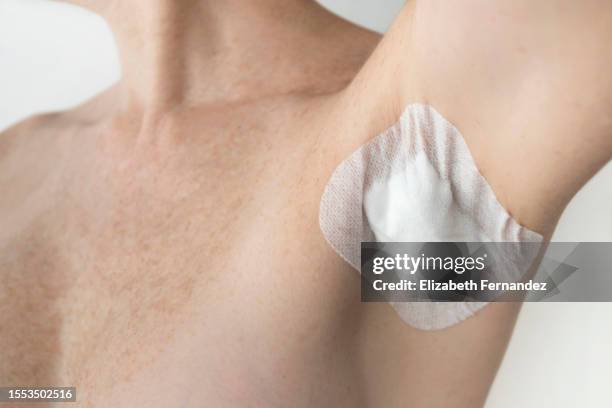 post-surgical epidermal cyst excision in female armpit - human arm stock pictures, royalty-free photos & images