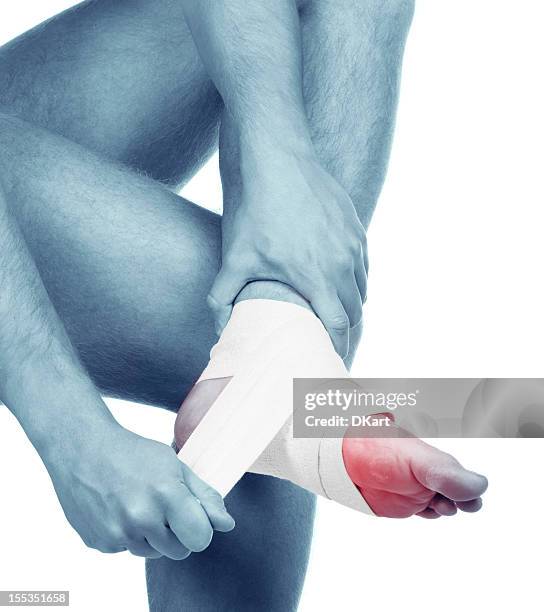 sports trauma of a foot. sprained ankle - elastic bandage stock pictures, royalty-free photos & images