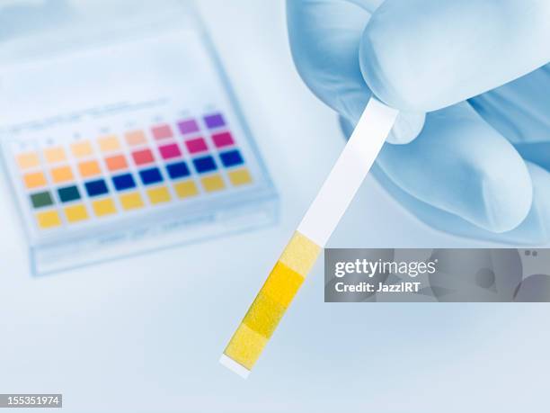 tira de papel indicador de ph de reposo en espécimen - urine sample fotografías e imágenes de stock