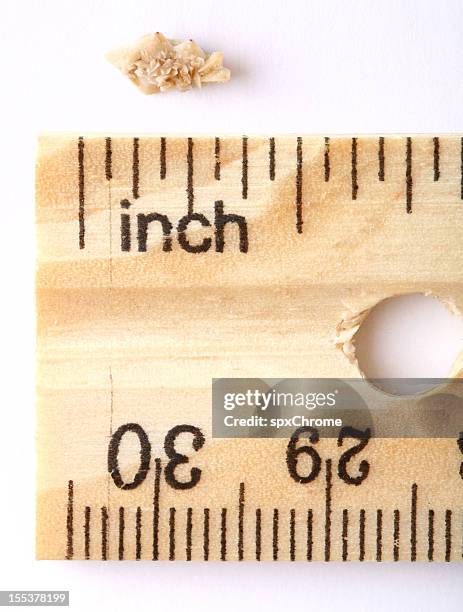 kidney stone - calcium oxalate dihydrate stock pictures, royalty-free photos & images