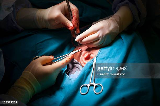 doctor stitching the patient - surgery stitches stock pictures, royalty-free photos & images