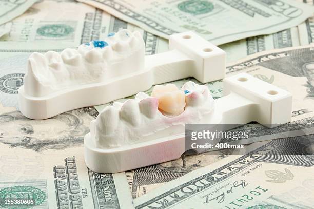 dental kosten-konzept - crown molding stock-fotos und bilder