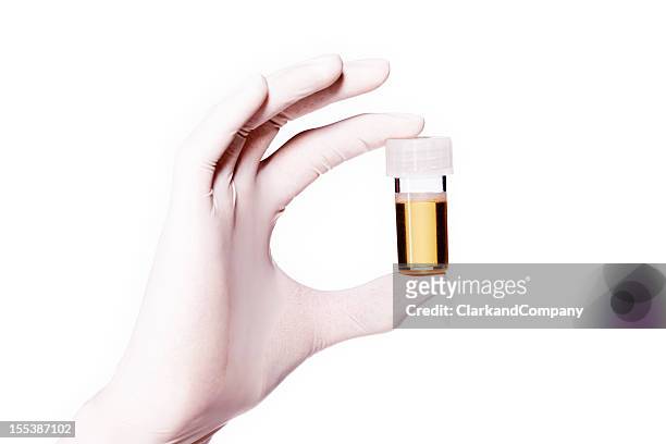 drug test urintest - analysis of urine stock-fotos und bilder