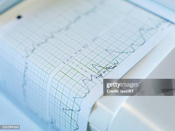 Cardiographic Machine Images Strapping Machine Photos and Premium High Res Pictures - Getty Images