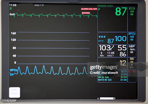 intensivstation messgerät - intensivstation stock-fotos und bilder