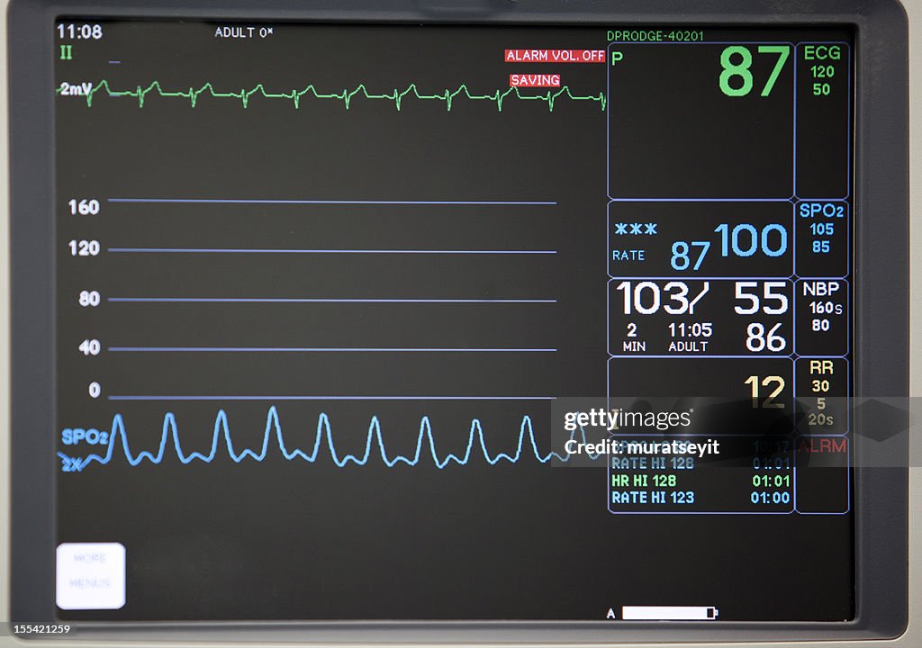 Close-up of intensive care unit monitoring screen