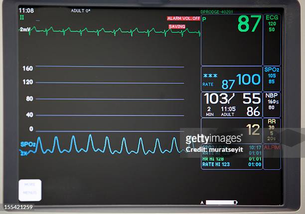 close-up of intensive care unit monitoring screen - intensive care unit stock pictures, royalty-free photos & images