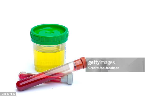 médico: sterile amostra de urina e exame de sangue - drug test - fotografias e filmes do acervo