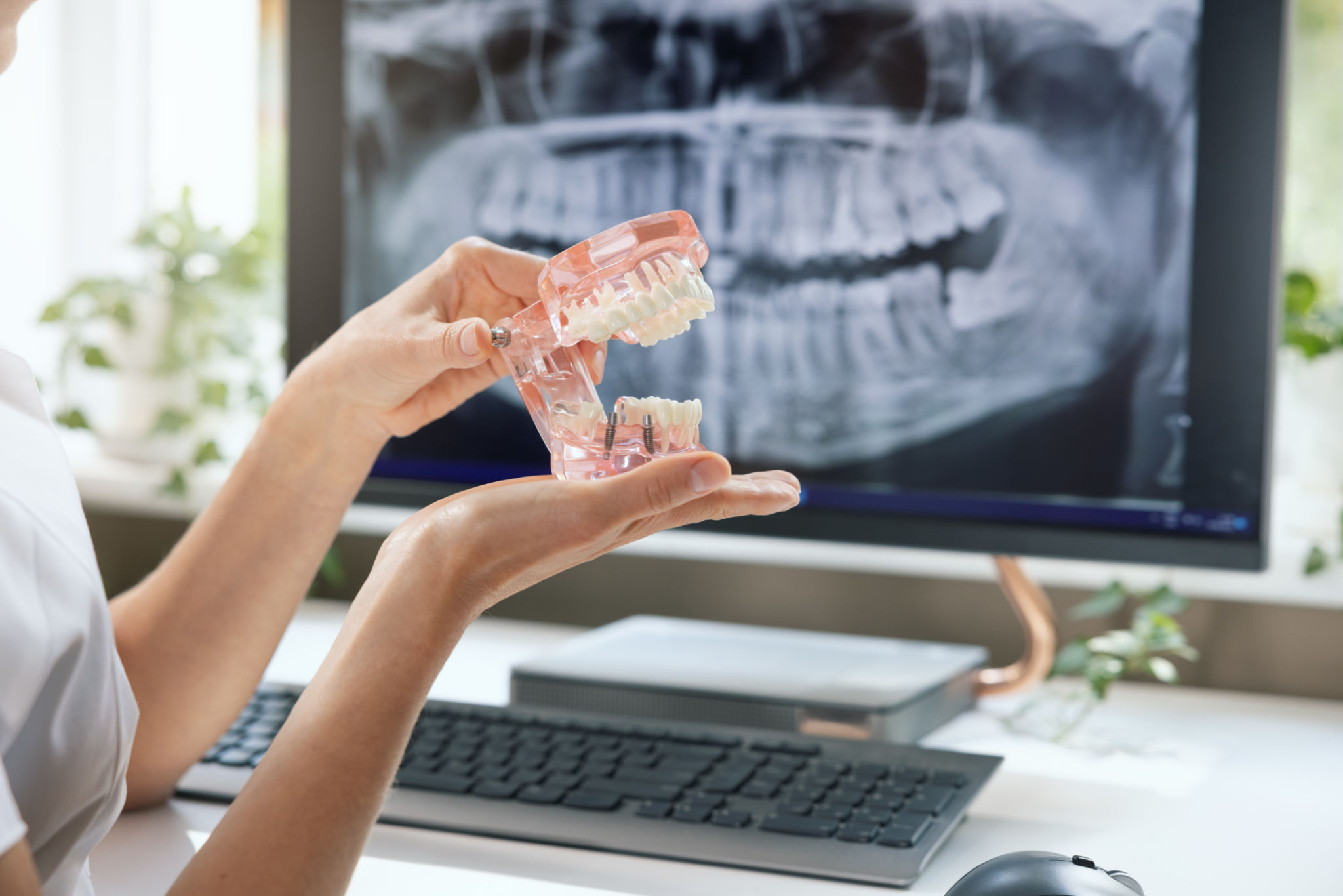 dentist implantologist showing teeth model with implant screw sample in clinics office dentist implantologist showing teeth model with implant screw sample in clinics office