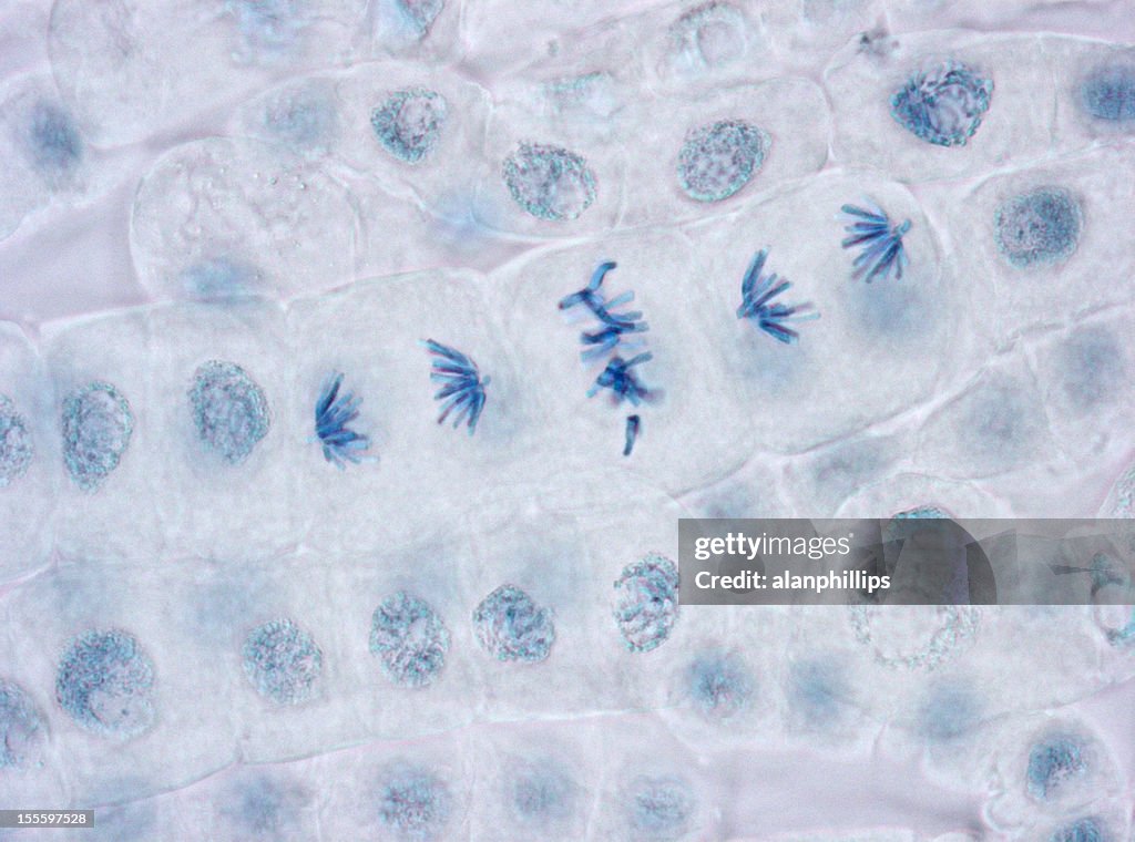 Microscope image of metaphase and anaphase in plant cells