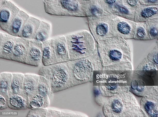 plant cells stained for nuclei with one cell at metaphase - photomicrograph root tip stock pictures, royalty-free photos & images