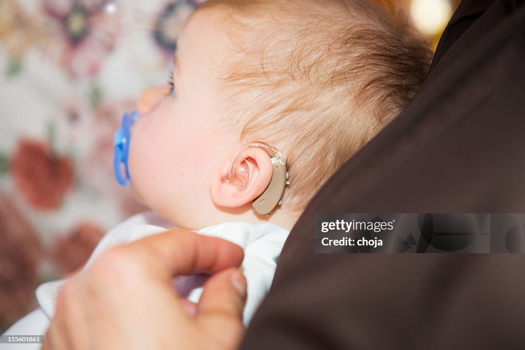 Cute baby boy with hearing aid