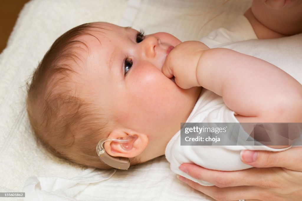 Cute baby boy with hearing aid