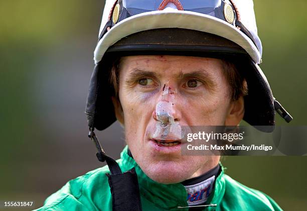 Tony McCoy with a bandaged, bloody, bruised and stitched face, nose and lip after being kicked in the face by a horse after a fall yesterday prepares...