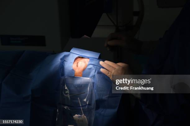 excimer laser surgery - excimer stockfoto's en -beelden