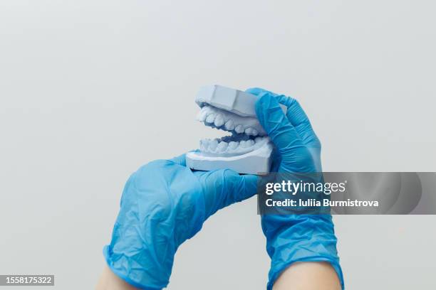 dentist skilled hands in blue protective gloves gracefully displaying dental mold with replica of human teeth - crown molding bildbanksfoton och bilder