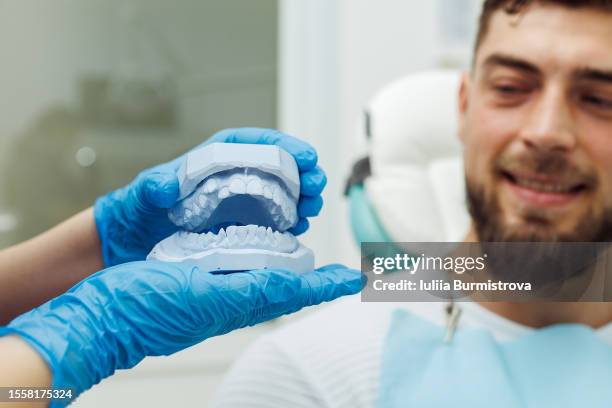 unrecognizable dentist explains male patient how braces work using dental mold - ortodonzia foto e immagini stock
