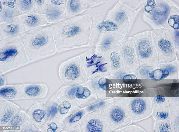 plant cells stained for nuclei with one cell in metaphase - mitosis bildbanksfoton och bilder