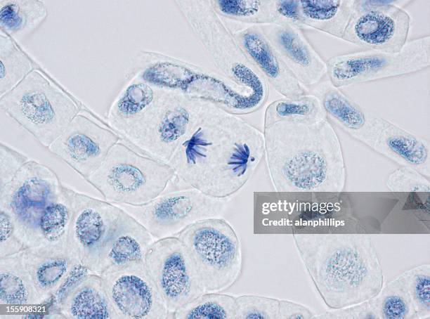 pianta cellule macchiati per nuclei con uno in anaphase - organulo-cellulare foto e immagini stock
