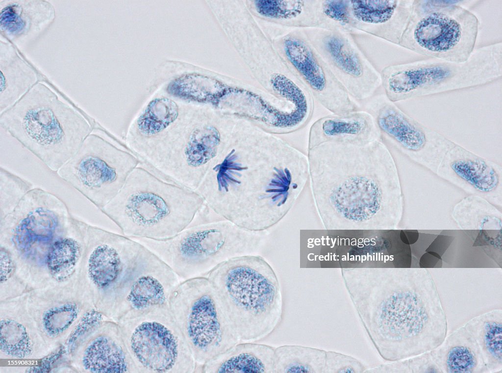 Plant cells stained for nuclei with one in anaphase