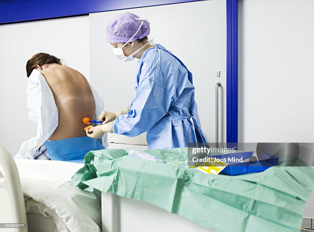 Woman receiving epidural anaesthesia catheter, PDA