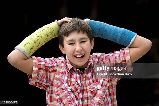 boy with two broken arms with happy smile. - broken arm foto e immagini stock