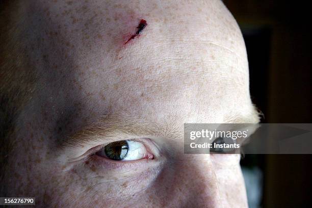 wounded in action - dry eye stock pictures, royalty-free photos & images
