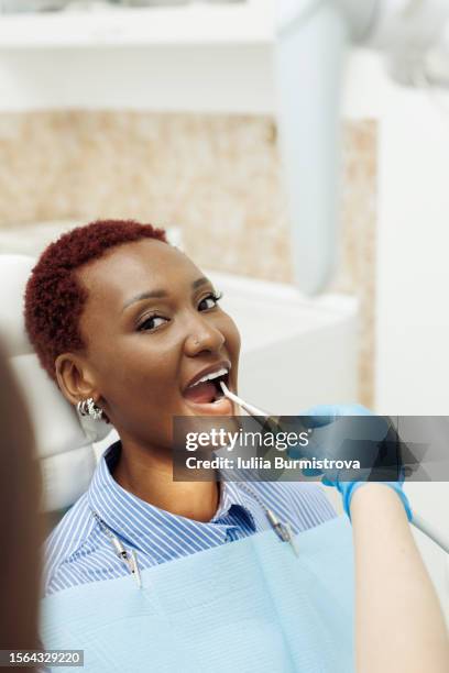 hand of unrecognizable dentist assistant holding dental laser in mouth of good-looking black female patient - herpes labial - fotografias e filmes do acervo