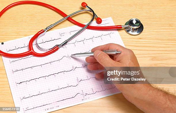 doctor with ecg print out - heartbeat foto e immagini stock