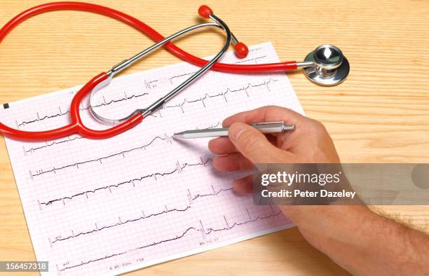 doctor with ecg print out - ritmo-cardíaco imagens e fotografias de stock