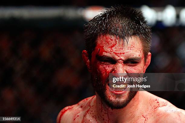 Cut and bloodied Carlos Condit reacts after a round against Georges St-Pierre in their welterweight title bout during UFC 154 on November 17, 2012 at...