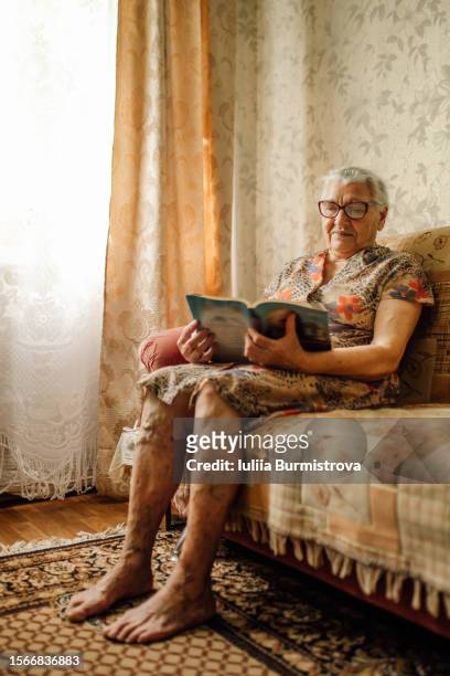 fragile senior woman in comfy housecoat with marks of varicose veins disease on legs sits on sofa reading book - varices fotografías e imágenes de stock